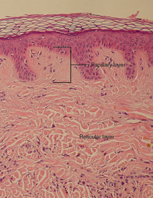 detailed hand painted diagram showing very close-up magnification of human skin